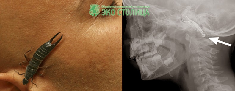 Уховертка залезла в ухо