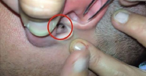 Невероятно, но двухвостка может заползти в ухо