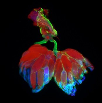 Яичники и матка мухи фото