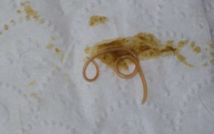 Как узнать, есть ли глисты у собаки: симптомы, диагностика и лечение