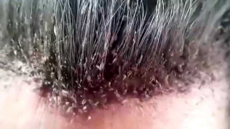 Присутствие яиц и личинок