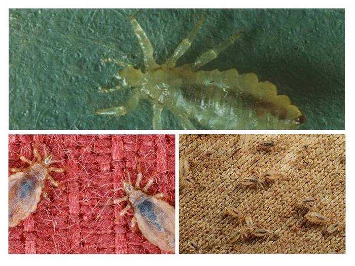 Как выглядит вша: фото и описание