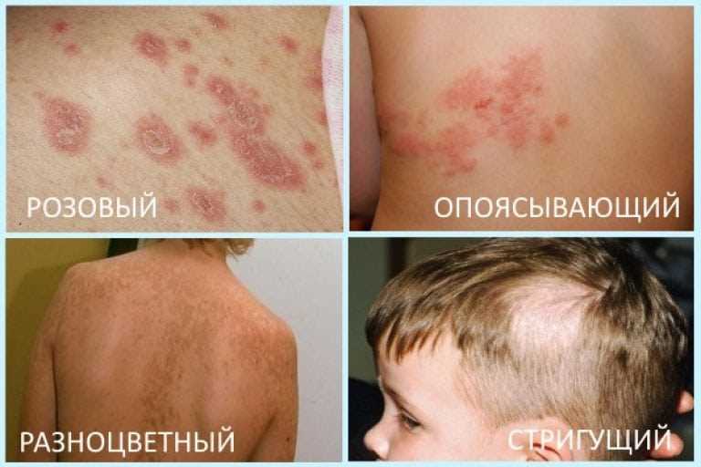 Необходимая защита при путешествиях в экзотические страны