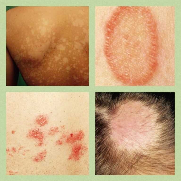 Врачи, которые помогают выявить заболевание и пролечить его