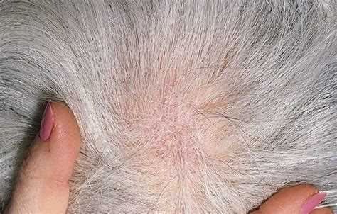 Нарушение гигиены