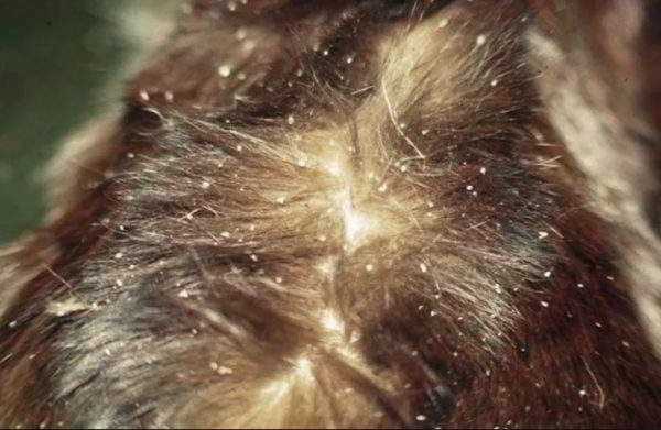 Кожные изменения