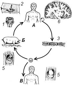 Как лечить свиной цепень